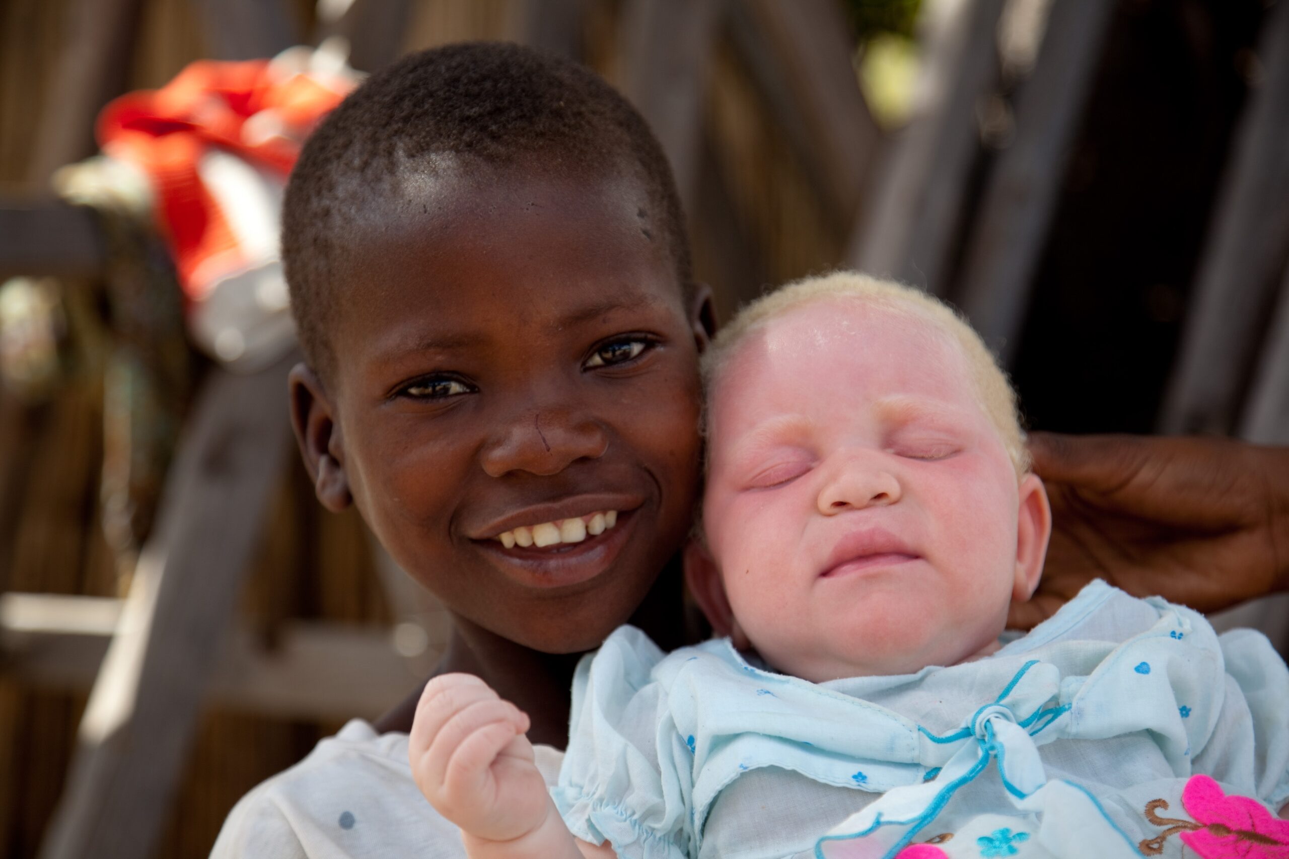 Comment le Mythe de l’Albinos met en danger des enfants tanzaniens