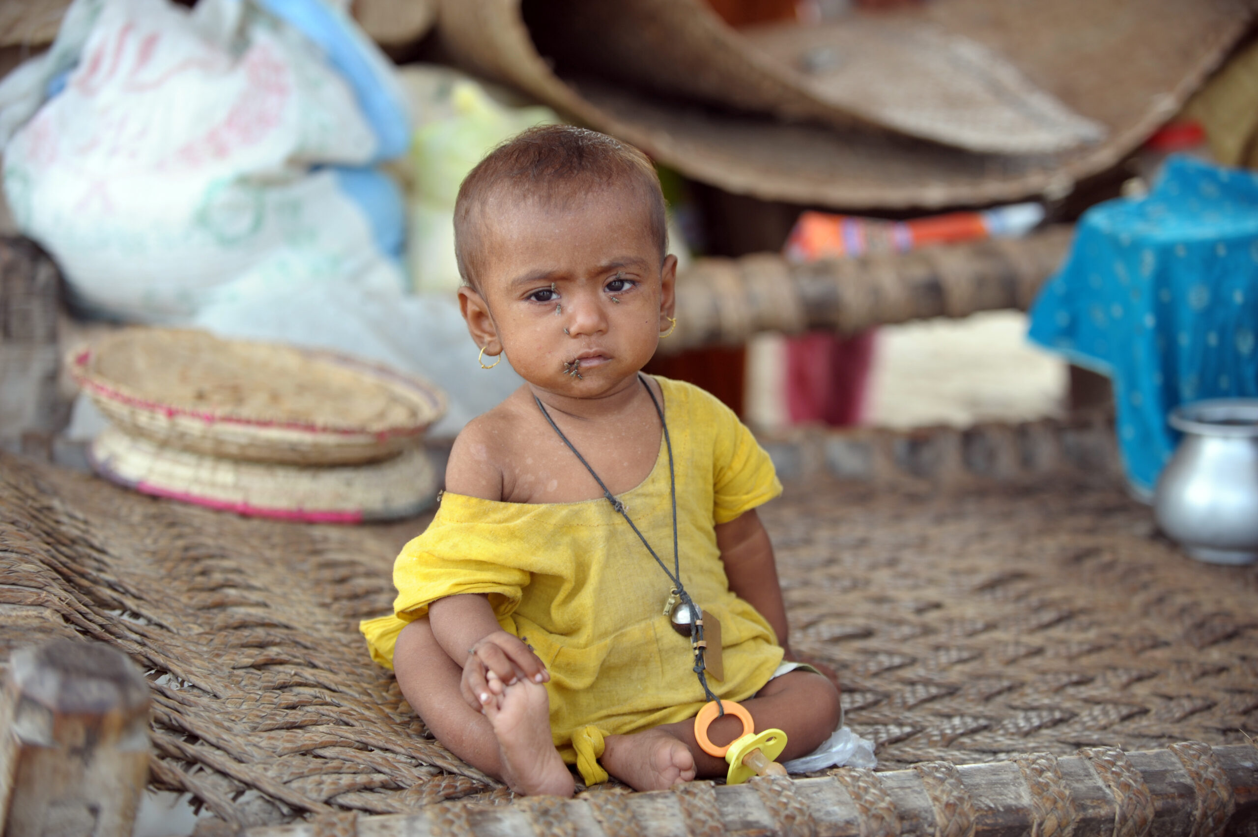 Les taux de malnutrition les plus élevés enregistrés chez les enfants au Pakistan